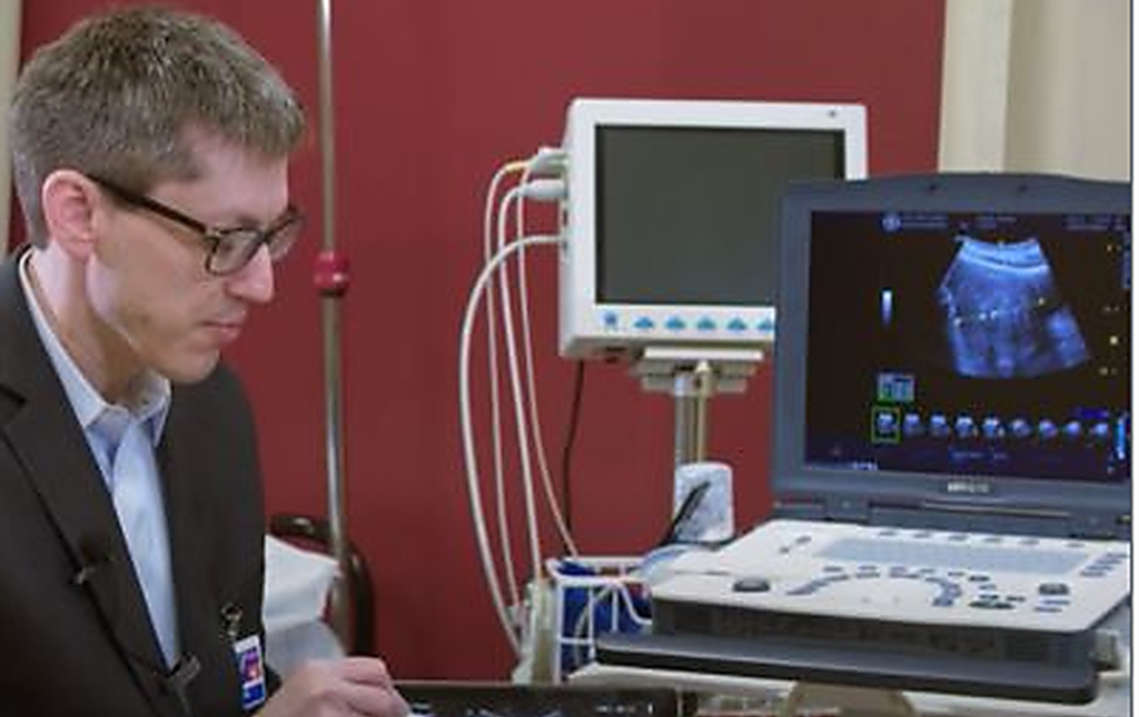 The Benefits Of Uterine Fibroid Embolization (Ufe) 3 enlarged photo of Dr. White UFE procedure